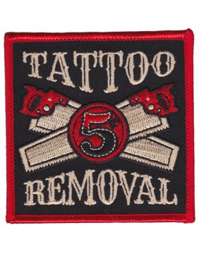 Kustom Kreeps Parche Tattoo Removal